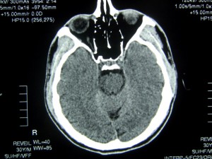 Scanner cérébral - Imagerie Médicale